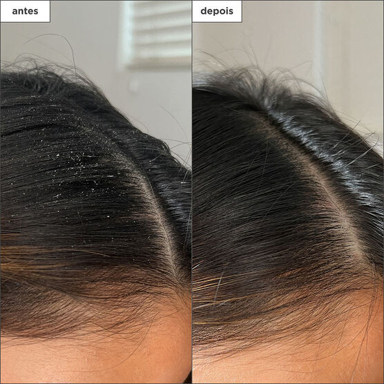Scalp Revival Build-up Detox Spray